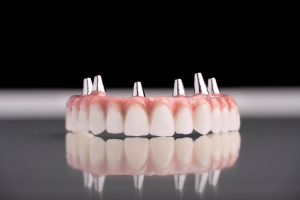 The Advantages Of Implant Supported Dentures Over Regular Ones